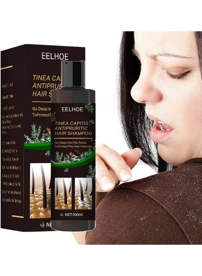 إيلهو شامبو الشعر المضاد للحكة ، شامبو مضاد للقشرة ، شامبو لفروة الرأس المعرضة لالتهاب الجريبات ، التهاب الجلد ، قشرة الرأس ، العث ، حكة وقشرة الرأس ، يعالج قشرة الرأس والتهاب الجلد الدهني - Image 2